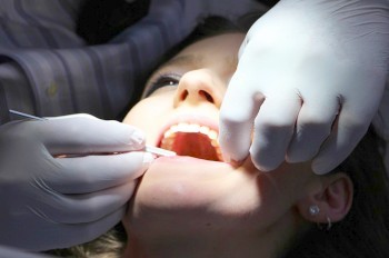 В России стоматолог удалила пациентке 22 здоровых зуба