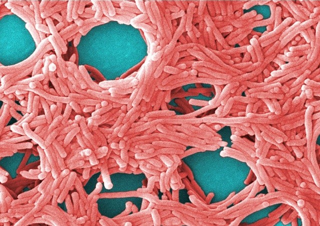 Заболеваемость легионеллезом бьет рекорды в Чехии