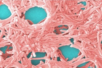 Заболеваемость легионеллезом бьет рекорды в Чехии